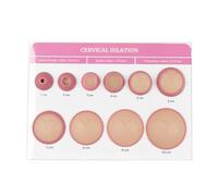 Simulador de dilatación cervical para educación médica, modelo de enseñanza ginecológica para entrenamiento de parteras y doulas, maniquí de dilatación de 1 a 10 cm