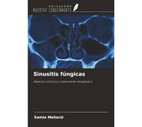 Sinusitis fúngicas: Aspectos clínicos y tratamiento terapéutico