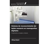 Sistema de reconocimiento del tejido mamario en mamografías digitales: Fundamentos, conceptos y métodos
