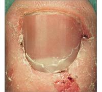 Skrape - New Killer America