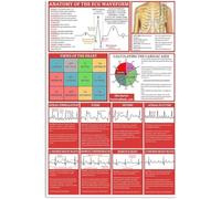 SMGLRUEAT Antique EKG Waveform Chart Metal Lead II V1 V5 Placement Poster Arrhythmia Detection Guide Plaque Student Study Room Wall Decoration Tin Sign 8 X 12 inch