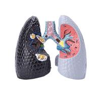 Smokers Lung Model + Healthy Lung Model, Human Lung Anatomy Model, Pathological Features and Accurate Anatomy Structure for The Effects Of Smoking On Lung Health