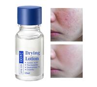 Solución De Granos: 10 Ml De Solutiion De Secado De Mancha Hidratante | Calmante Líquido De Mancha Facial | Solución De Grano Ideal Para Mujeres, Hombres, Preparación De Maquillaje, Viajes De Verano,