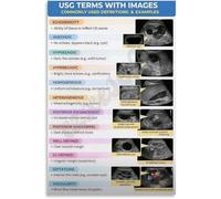 Sonographer Gift Ultrasound Terminology Art Print Medical Science Poster Anatomy Study Guide for Radiology Student Doctor Office Wall Decor(Unframed,16x24inch(40x60cm))