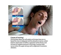 South Moon 100PCS Nasal Strips Easy Breathing Sleep Stop Snoring Relief Pressure