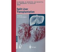 Split Liver transplantation: Theoretical and practical aspects
