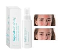 Spray Facial Hidratante | Tónico 120ML Térmico | Hidratante Rostro - para Piel Seca Hombres y Mujeres Adolescente