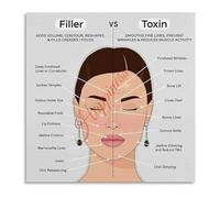 SSOPTMCB Botox vs Dermal Filler Comparison Chart Poster Cosmetic Injection Reference for Clinic Decor Canvas Wall-Art(Framed,16x24inch(40x60cm))
