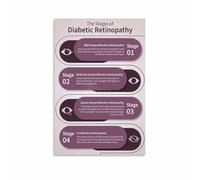 SSOPTMCB Diabetic Retinopathy Educational Poster Eye Disease Anatomy Symptoms Stages Guide Visual Reference Chart for Clinic Hospital Classroom Decor(Framed,12x18inch(30x45cm))