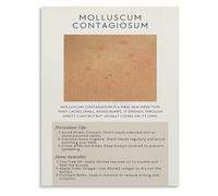 SSOPTMCB Educational Wall-Art on Skin Health Informative Science Poster for Student Classroom or Home Library Decor(Unframed,16x24inch(40x60cm))