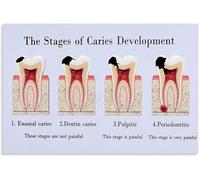 SSOPTMCB The Science of a Healthy Tooth Detailed Diagram Poster Canvas Wall-Art for University Library or Student Room(Unframed,16x24inch(40x60cm))