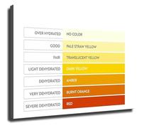 SSOPTMCB Understanding Urine Color Chart Poster Wall-Art for Health Office Decor(Unframed,12x18inch(30x45cm))