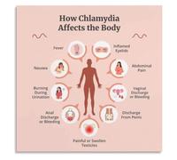 STD Education Poster Chlamydia Symptom Identification Chart