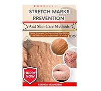 Stretch Marks Prevention And Skin Care Methods: Gentle Strategies For Supporting Skin Health And Reducing The Appearance Of Marks