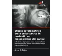 Studio cefalometrico della sella turcica in pazienti con malposizione dei canini: Sella turcica: depressione ossea situata nell'osso sfenoide del ... che ospita e protegge la ghiandola pituitaria