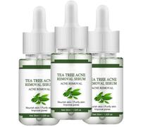 Suero facial antiacné, hidratante profesional para cicatrices y acné. Ingredientes naturales, textura ligera y no pegajosa que equilibra la piel. Apto para adolescentes y adultos.