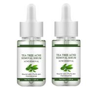 Suero facial antiacné, hidratante profesional para cicatrices y acné. Ingredientes naturales, textura ligera y no pegajosa que equilibra la piel. Apto para adolescentes y adultos.