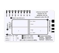 Sunmeit Regla de ECG de 7 Pasos, Regla de ECG de 7 Pasos para Interpretación de ECG/EKG, Herramienta Rápida y Veloz de Análisis y Medición Cardíaca
