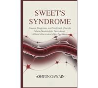 Sweet’s Syndrome: Causes, Diagnosis, and Treatment of Acute Febrile Neutrophilic Dermatosis , A Rare Inflammatory Skin Condition