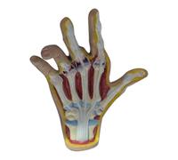 Swiixxer Modelo de Mano de Osteoartritis, Modelo de Patología de la Mano, Réplica de Anatomía y Fisiología, Modelo de Anatomía del Consultorio