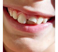 SWIMMING PAUL - SMILING THROUGH THE PAIN [Vinilo]