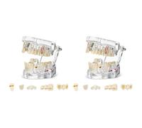 Sxmrmnx Modelo de dientes de enfermedad, modelo de implante de tipodontes dentales con dientes extraíbles, demostración de dientes estándar para dentistas