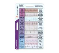 Tarjeta De Bolsillo De Ritmo EKG/EKG | Tarjeta De Identificación De Interpretación Del Ritmo | De Referencia De ECG De Doble Cara Con Calibradores | Guía De ECG Para Profesionales Y E