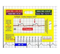 Tarjeta de Interpretación | Tarjeta De Referencia Portátil,Materiales De Medición Portátiles Para Rotaciones Clínicas Médicas Y Cardiológicas