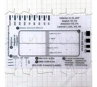 Tarjeta de regla de ECG médica, herramienta de medición profesional para el cuidado de la salud, guía de análisis de frecuencia cardíaca y QRS