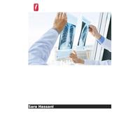 Taxas de recorrência do cancro após cirurgia conservadora da mama: com e sem radioterapia adjuvante com ponto de exame de radiologia