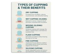 TCYNNQVD Hijama Suction Points Poster Alternative Medicine Decor | Meridian based cup positioning for detoxification and stagnant movement(Unframed,16x24inch(40x60cm))