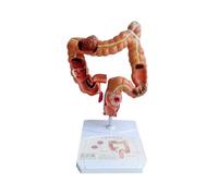 Teaching Model,Human Large Intestine Anatomy Model Visceral Lesion Model Human Digestive System Lear