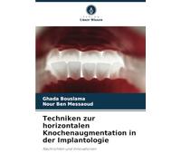 Techniken zur horizontalen Knochenaugmentation in der Implantologie: Nachrichten und Innovationen
