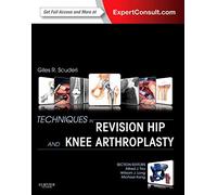 Techniques in Revision Hip and Knee Arthroplasty