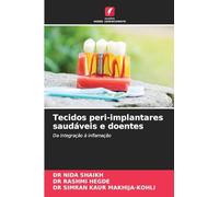 Tecidos peri-implantares saudáveis e doentes: Da integração à inflamação