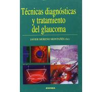 Técnicas diagnósticas y tratamiento del glaucoma (Libros de medicina)