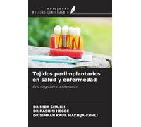 Tejidos periimplantarios en salud y enfermedad: De la integración a la inflamación
