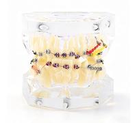 Telituny Tipodonto Oral Dental, Modelo Dental Ortodóntico, Modelo de Dientes Estándar con Dentadura de Resina y Alambre, Transparente Modelo Dientes para Laboratorio Escolar Cuidado Bucal