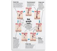 Telogen Rest Poster for Shedding Season | Three months dormant club hair push out new emerge(Framed,12x18inch(30x45cm))