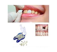 Temporary Denture Braces Occlude Upper Dentures, Veneer Dentures, Missing Teeth, Broken Teeth, And Gaps Between Teeth(75%off)_fe06 zxin