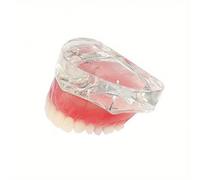 TEMU de implante dental | de implante de 4 uñas, Material: Plástico y Metal