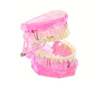 TEMU de Implante Dental y Restauración - Patológico/ Desmontable con Pieza Desmontable, Adecuado para Entrenamiento, Práctica de Implantes, Prostodoncia - Simulación Realista de Cirugía Oral