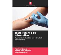 Teste cutâneo de tuberculina: Desempenho do diagnóstico para a deteção de tuberculose ativa