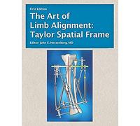 The Art of Limb Alignment: Taylor Spatial Frame