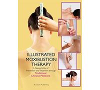 The Illustrated Moxibustion Therapy: A Natural Way of Prevention and Treatment through Traditional Chinese Medicine