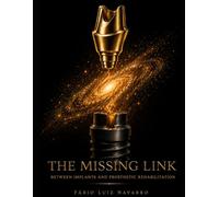 THE MISSING LINK: Between Implants and Prosthetic Rehabilitation (English Edition)