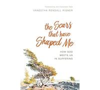 The Scars That Have Shaped Me: How God Meets Us in Suffering