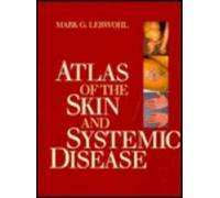 The Skin and Systemic Disease: Color Atlas