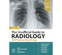 The Unofficial Guide to Radiology: 100 Practice Chest X-rays