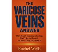 The Varicose Veins Answer: What's Actually Happening in Your Legs, Why It's Not Just Cosmetic, and How to Finally Get Ahead of It